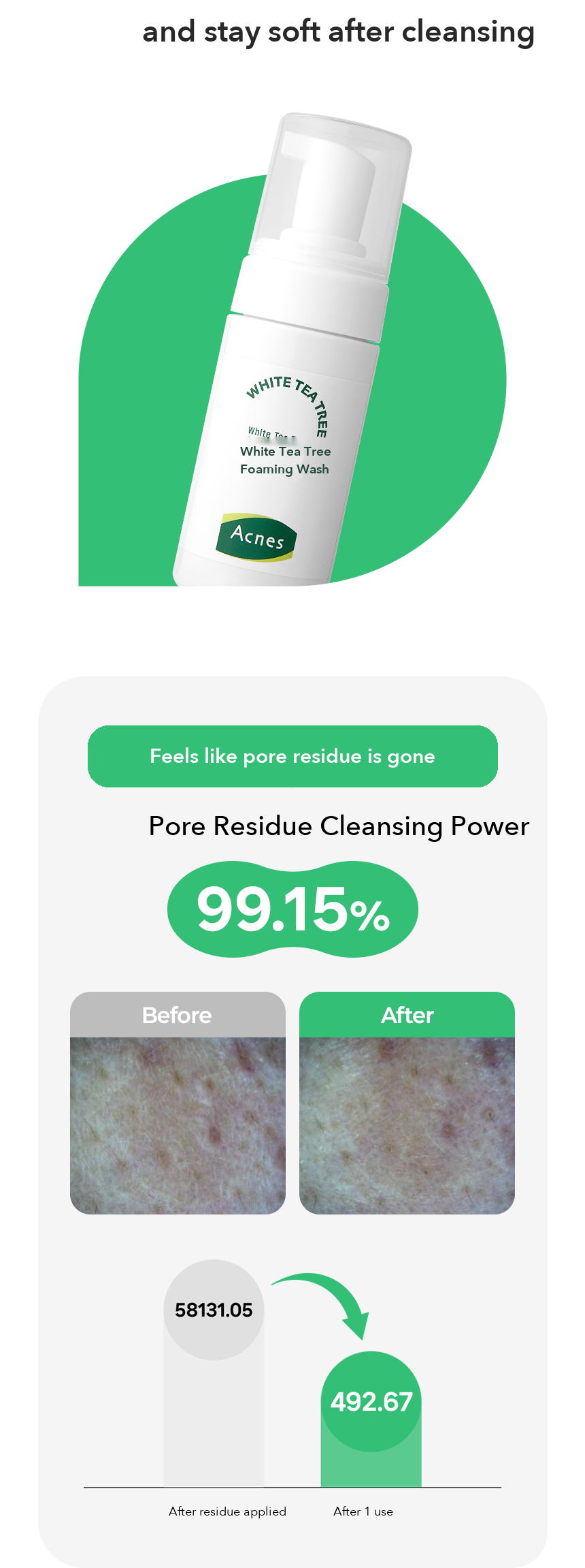 ACNES White Tea Tree Foaming Wash 100ml detail 05