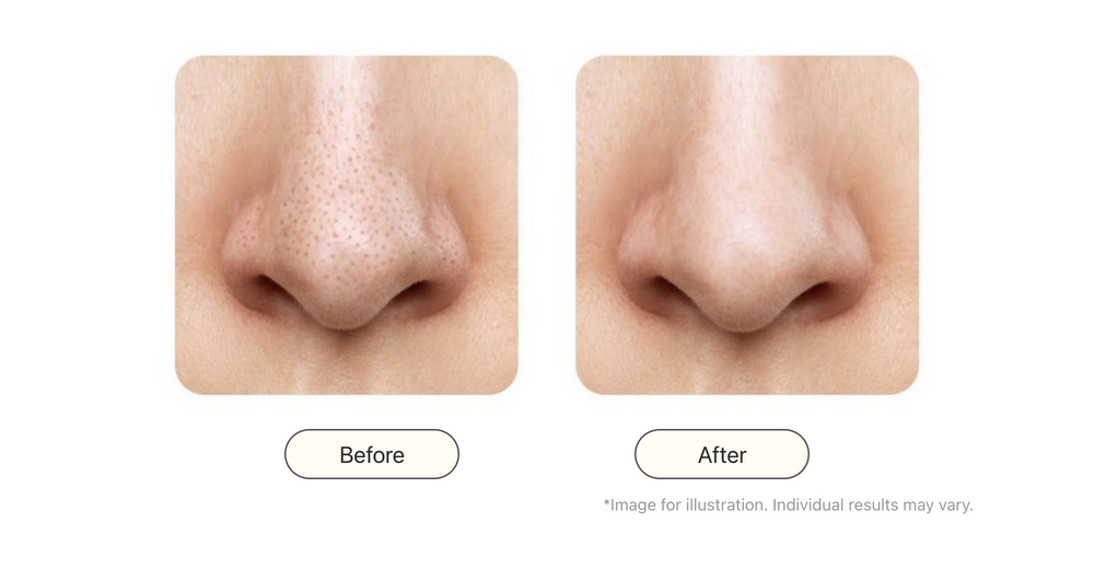 No Pore Cleansing Oil detail 8